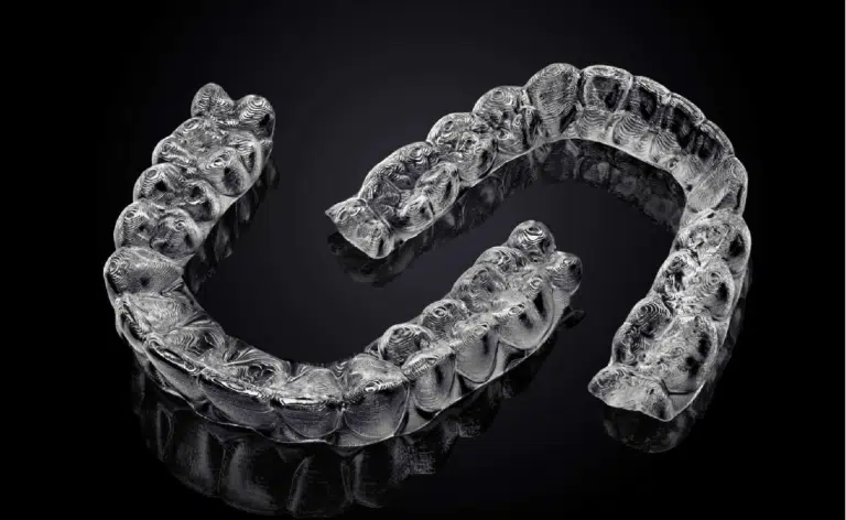 Why some Aligners are cheaper than others